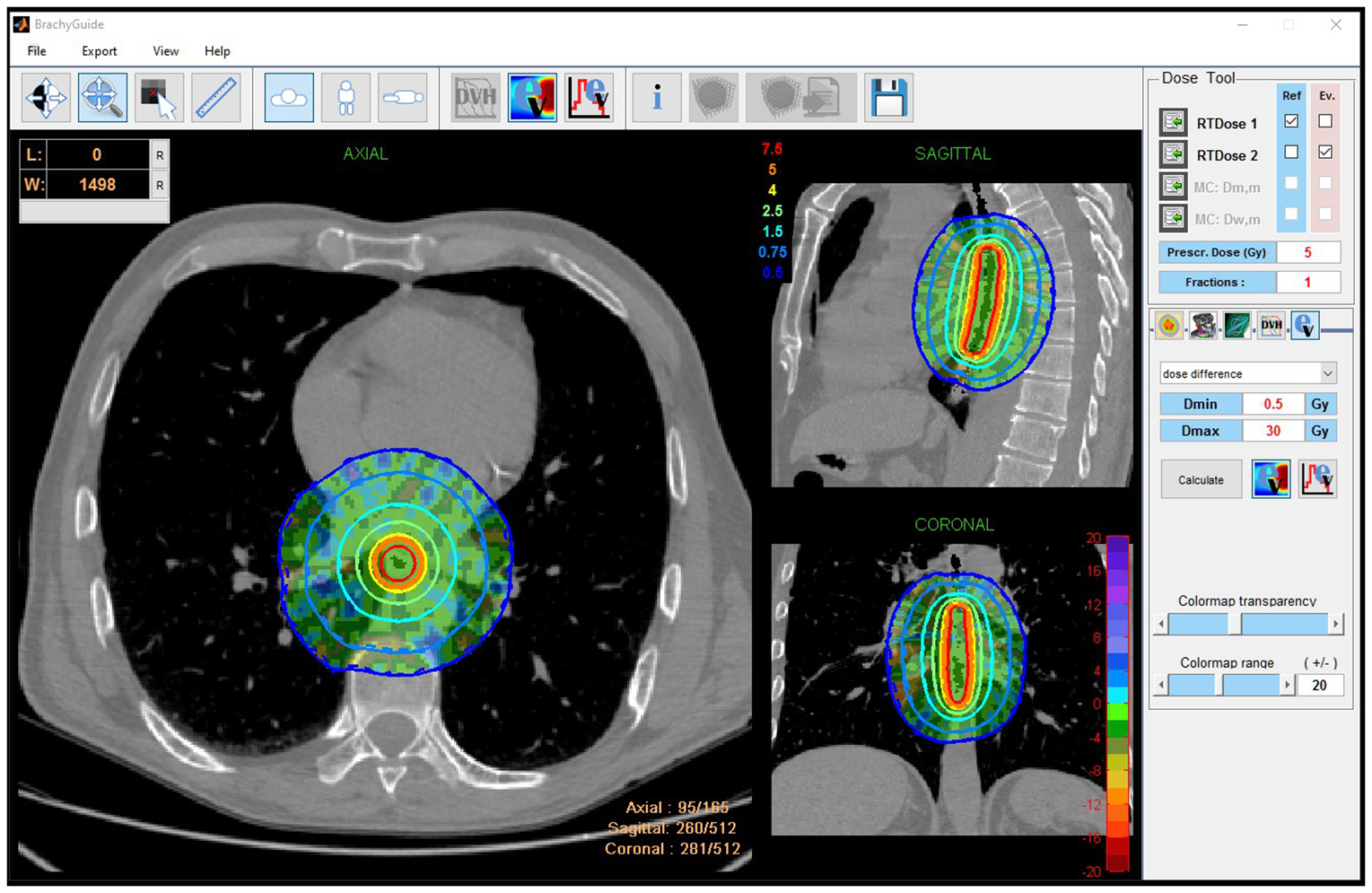 On source models for 192Ir HDR brachytherapy dosimetry using model ...