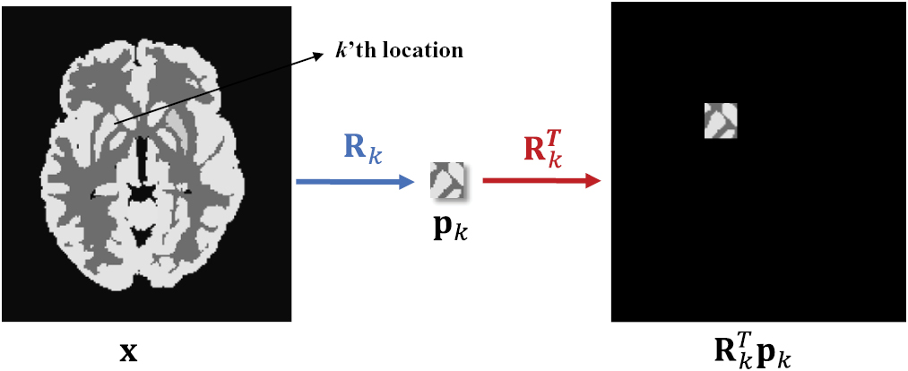 Patch-based image reconstruction for PET using prior-image derived ...