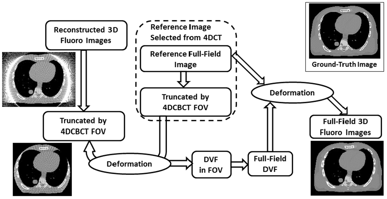 4D cone beam CT-based dose assessment for SBRT lung cancer treatment ...