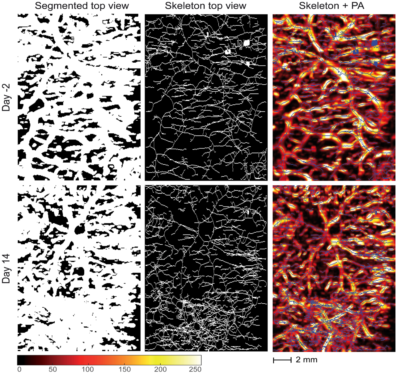 Skeletonization algorithm-based blood vessel quantification using in ...