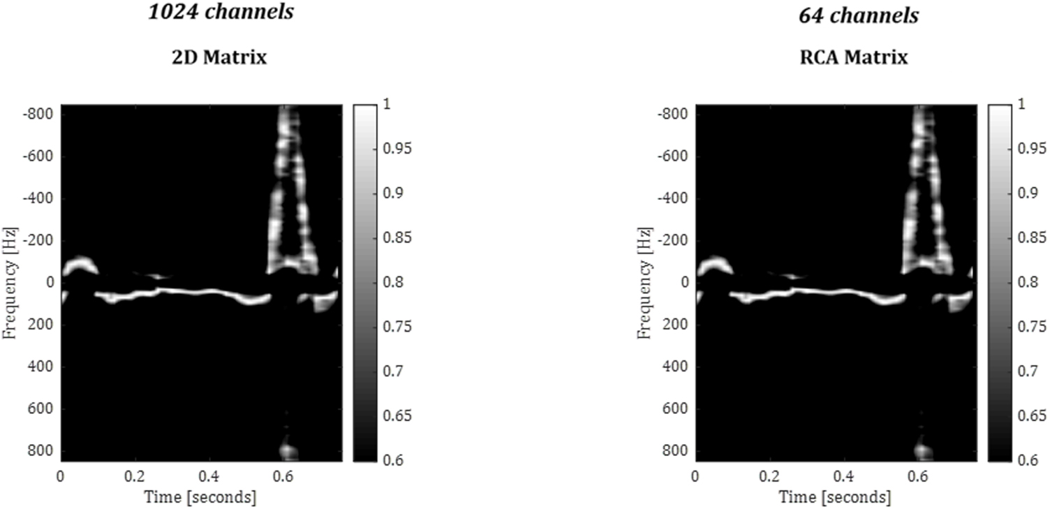 4D in vivo ultrafast ultrasound imaging using a row-column addressed ...