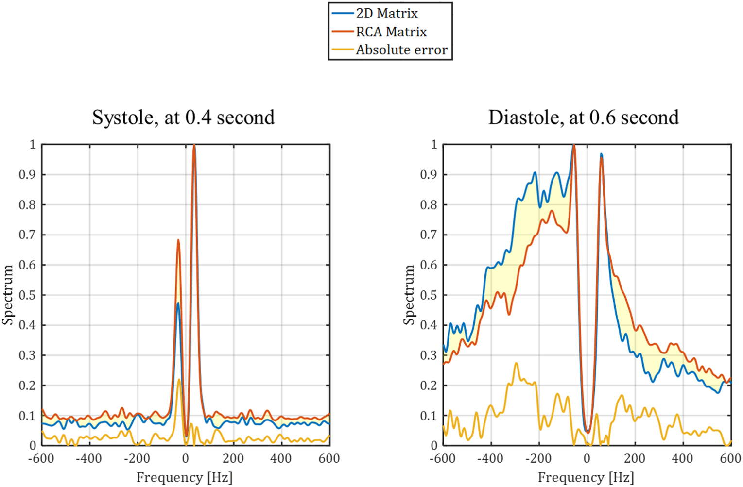 4D in vivo ultrafast ultrasound imaging using a row-column addressed ...