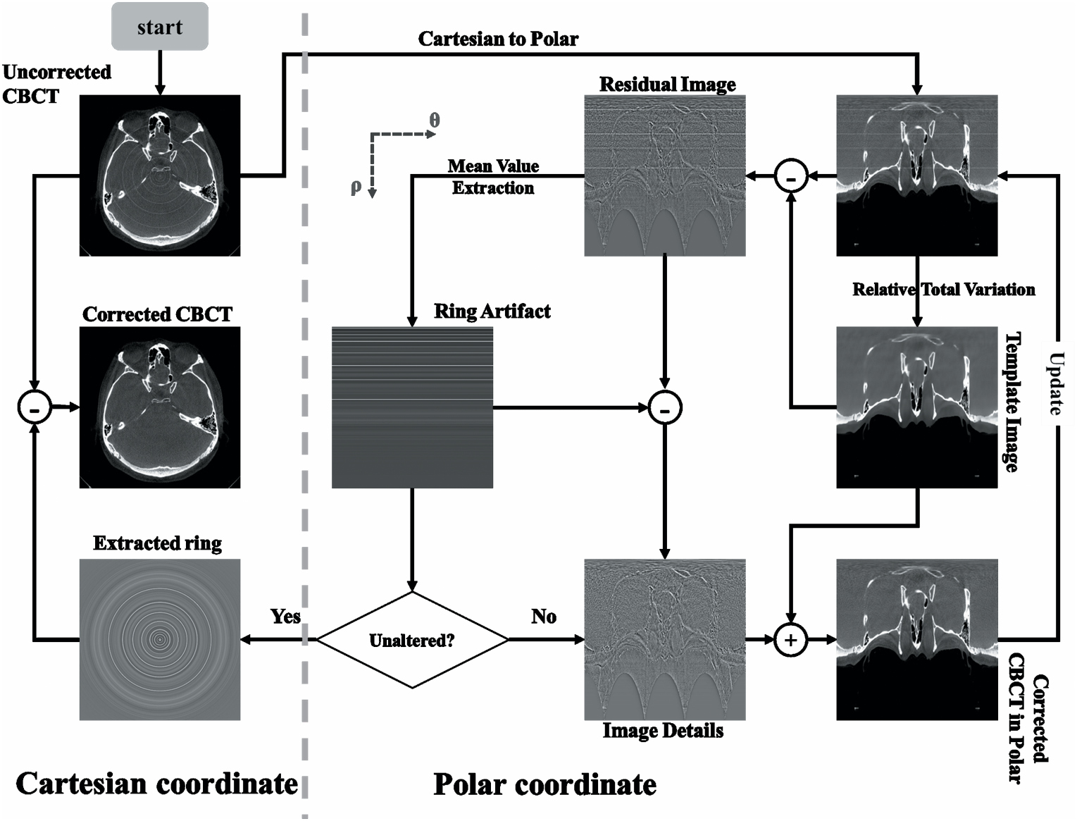 Iterative image-domain ring artifact removal in cone-beam CT - IOPscience
