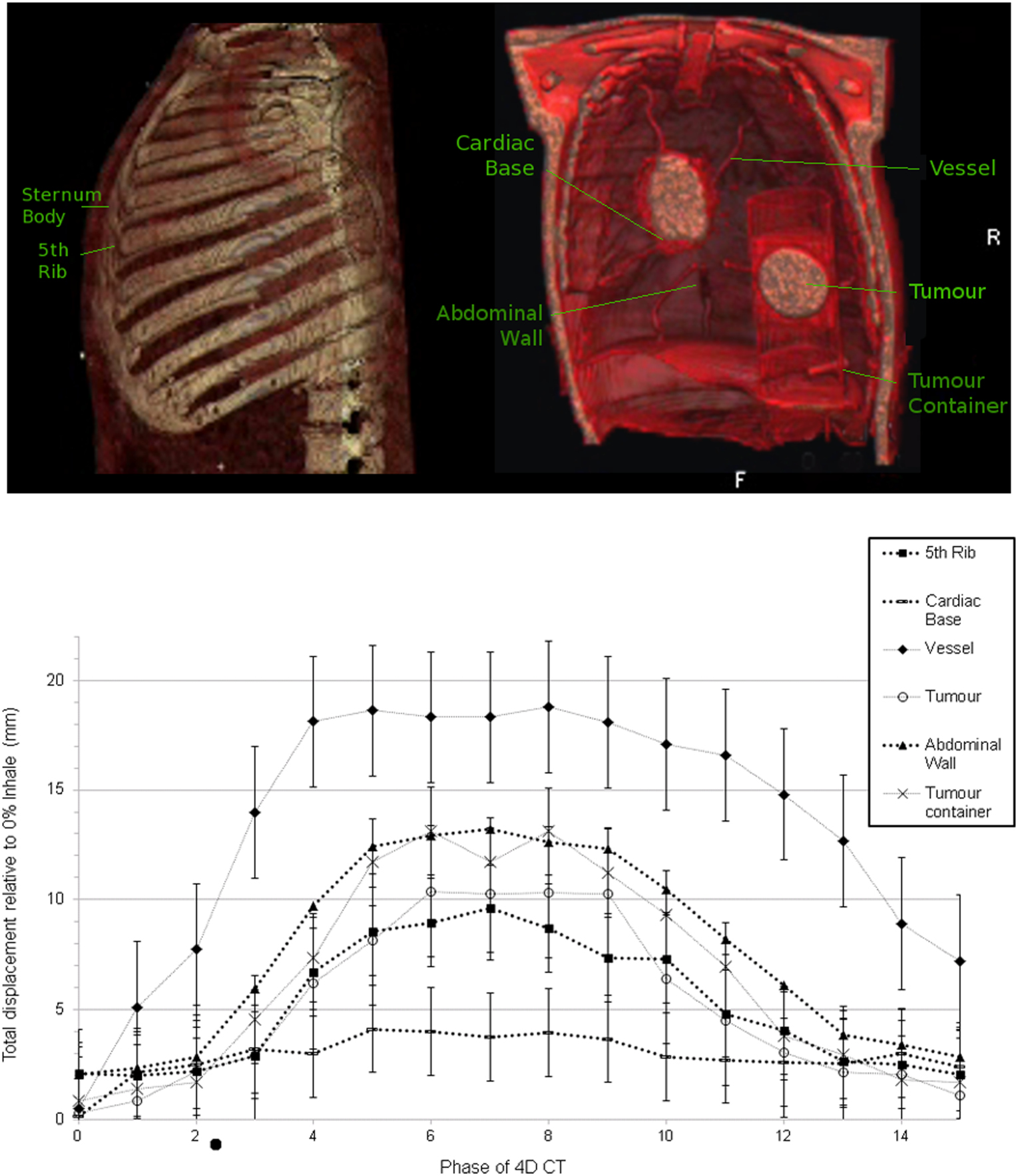 An anthropomorphic breathing phantom of the thorax for testing new ...