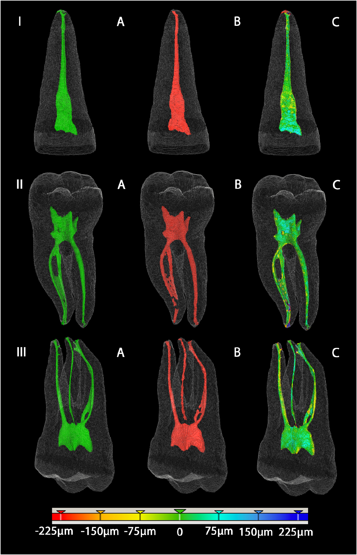 Comparison of an adaptive local thresholding method on CBCT and µCT ...