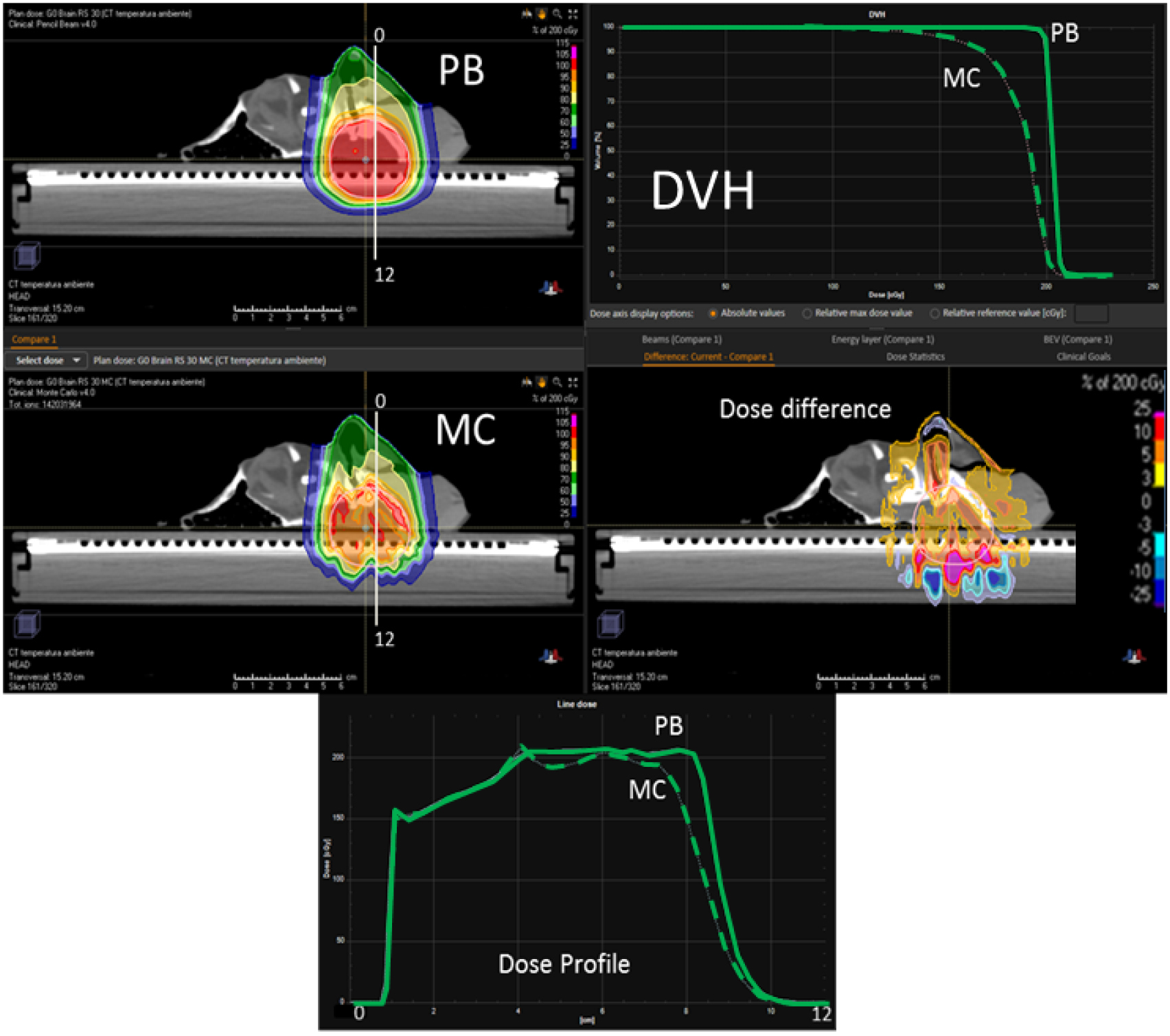 Improvements in pencil beam scanning proton therapy dose calculation ...