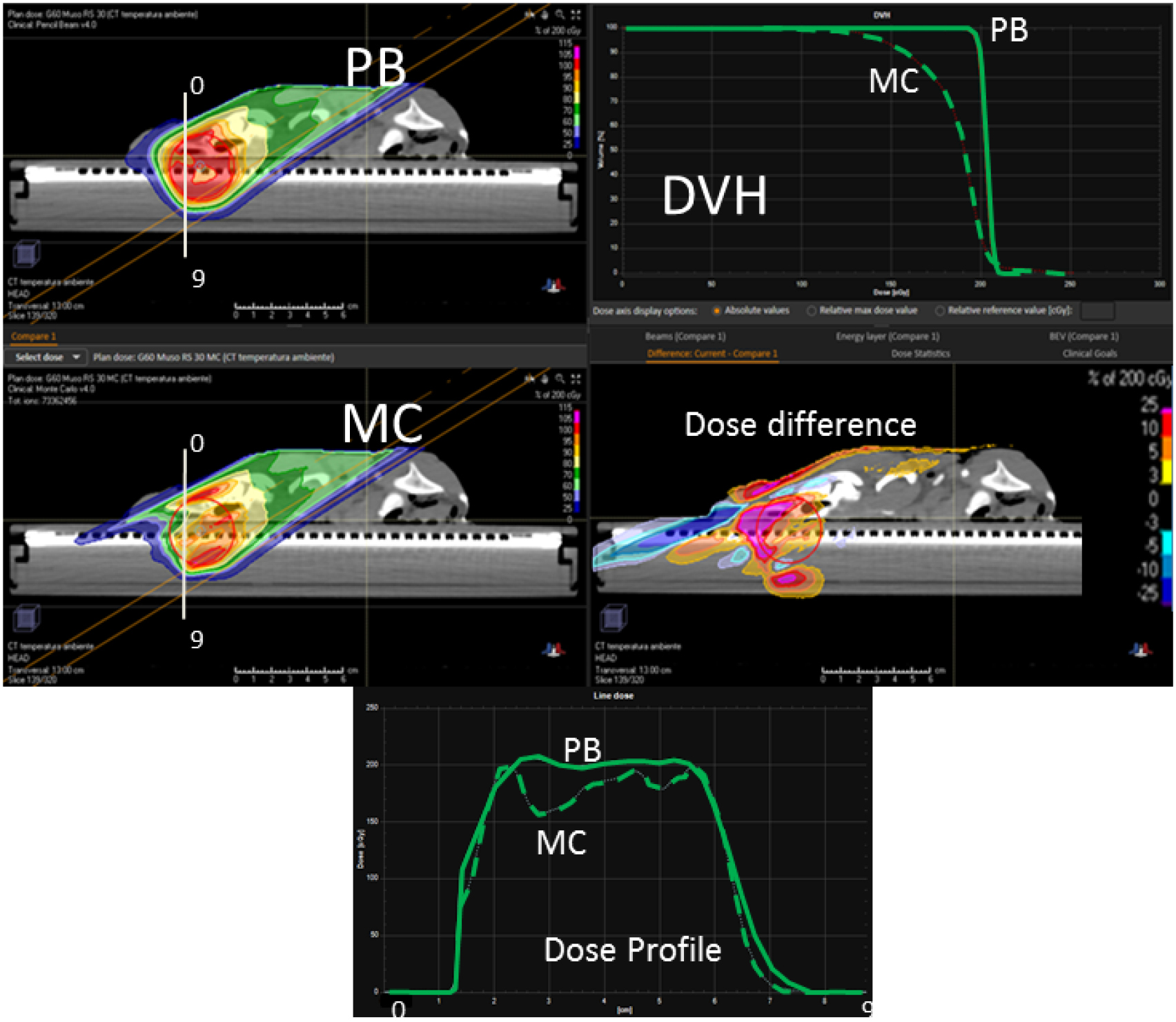 Improvements in pencil beam scanning proton therapy dose calculation ...