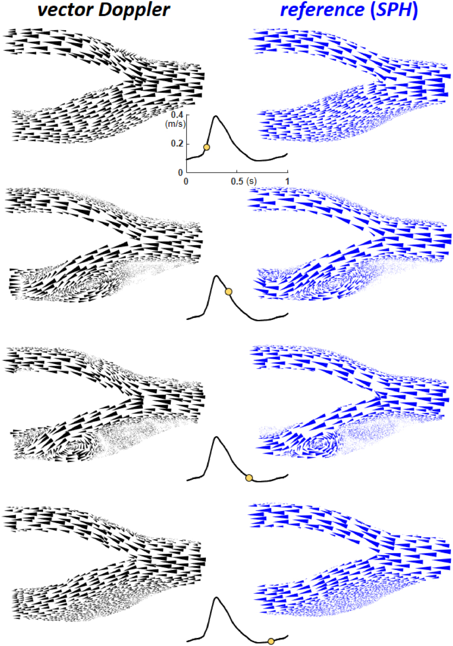 Vector Doppler Code Meshfree simulations of ultrasound vector flow imaging using smoothed ...