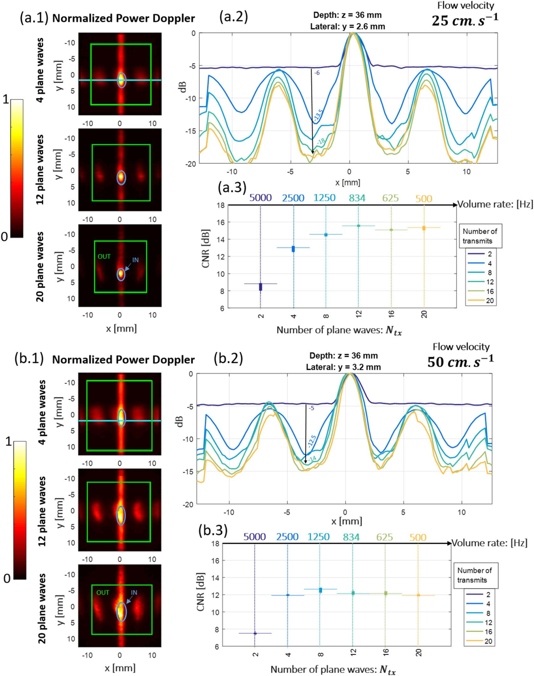A large aperture row column addressed probe for in vivo 4D ultrafast ...
