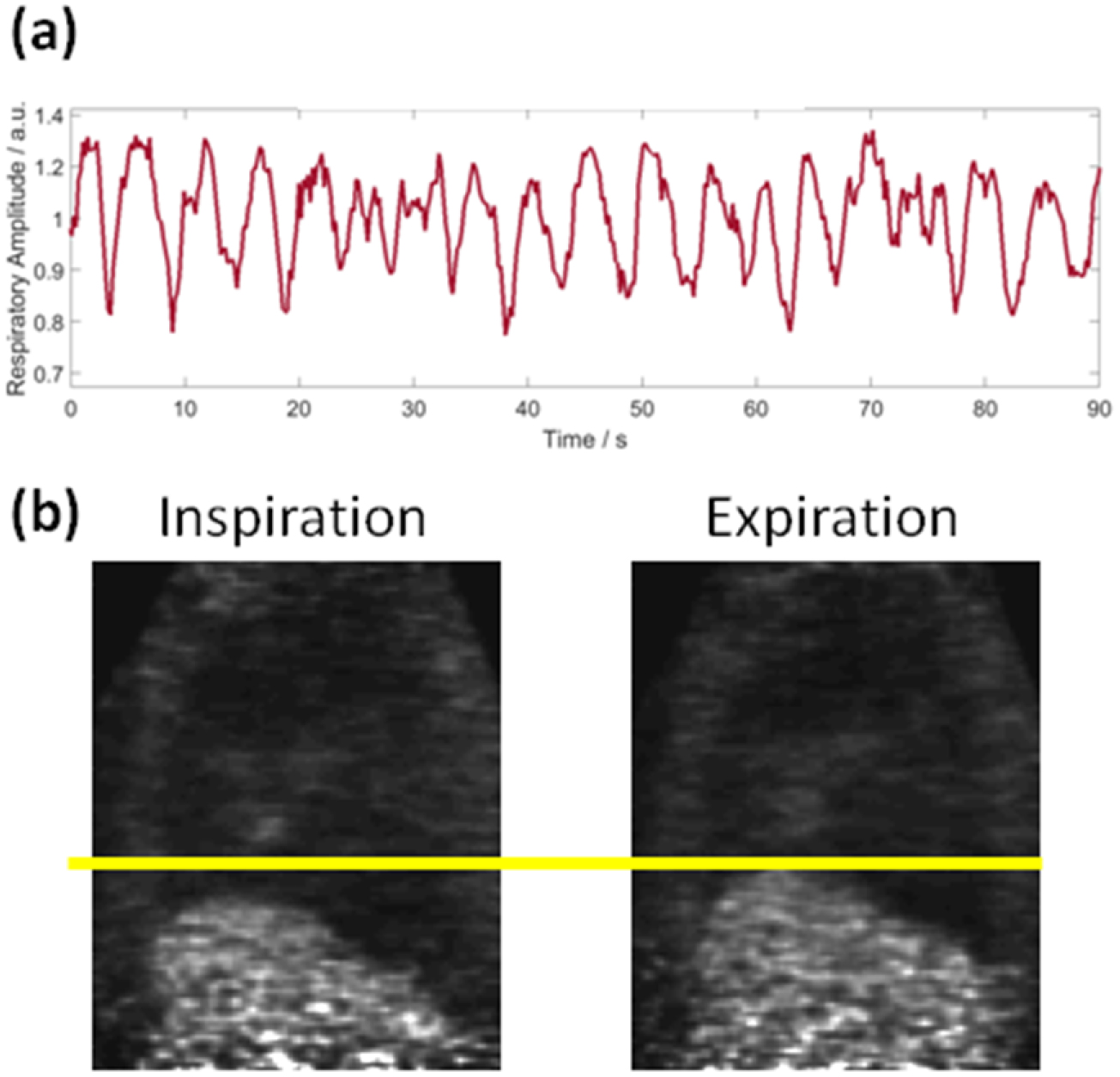 Correction of respiratory and cardiac motion in cardiac PET/MR using MR ...