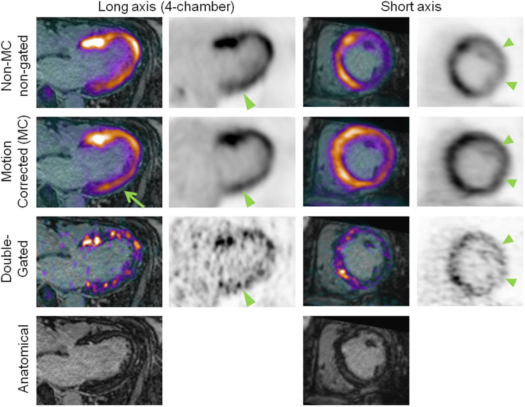 Correction of respiratory and cardiac motion in cardiac PET/MR using MR ...