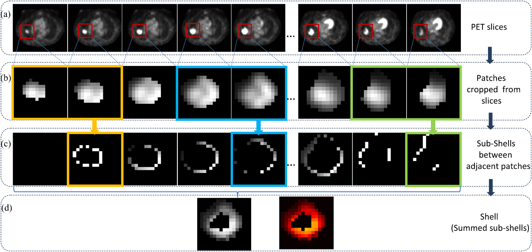 Tp Shell Radiotherapy Shell feature: a new radiomics descriptor for predicting distant ...