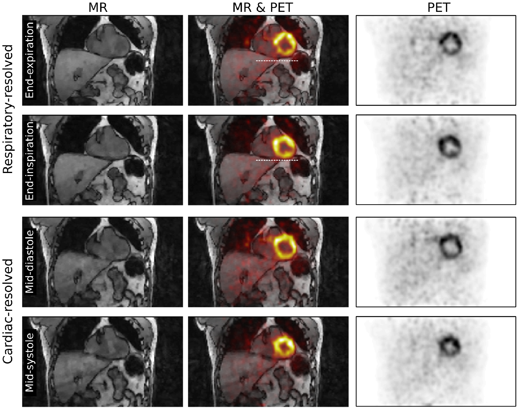 Joint cardiac and respiratory motion estimation for motion-corrected ...