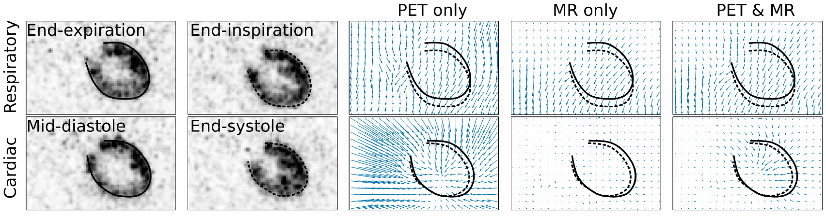 Joint cardiac and respiratory motion estimation for motion-corrected ...