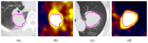 Tumor co-segmentation in PET/CT using multi-modality fully ...