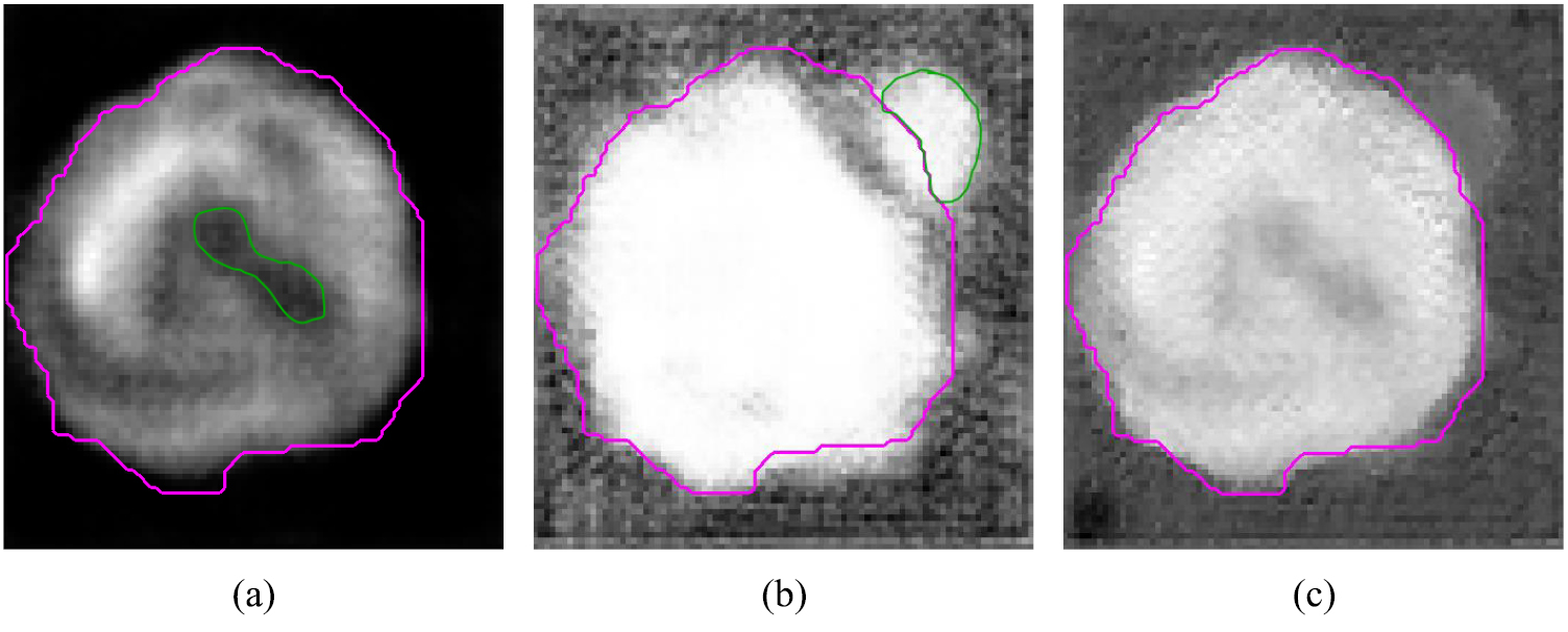 Tumor co-segmentation in PET/CT using multi-modality fully ...