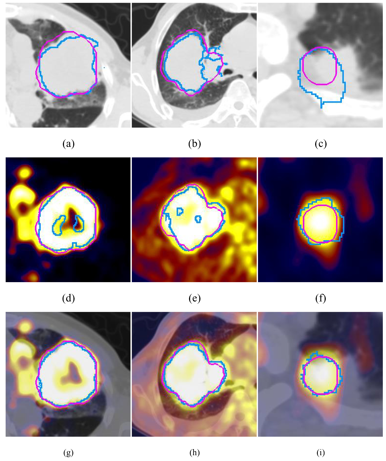 Tumor co-segmentation in PET/CT using multi-modality fully ...