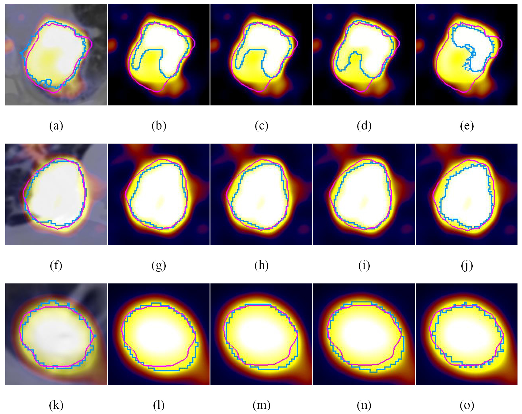 Tumor co-segmentation in PET/CT using multi-modality fully ...