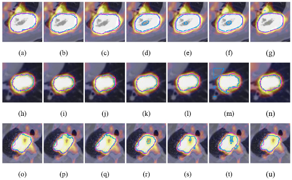 Tumor co-segmentation in PET/CT using multi-modality fully ...