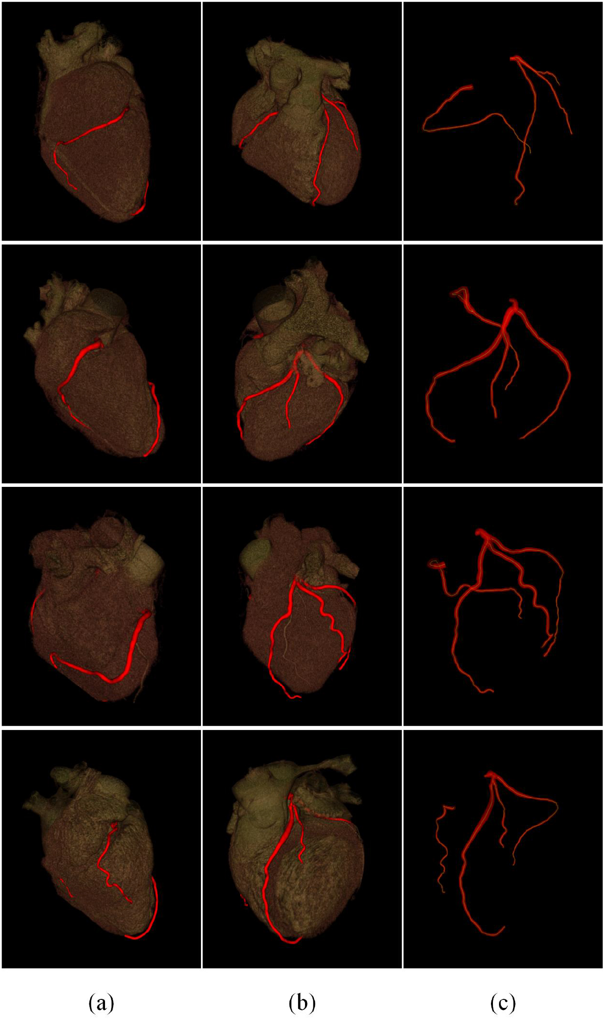 Deep feature regression (DFR) for 3D vessel segmentation - IOPscience