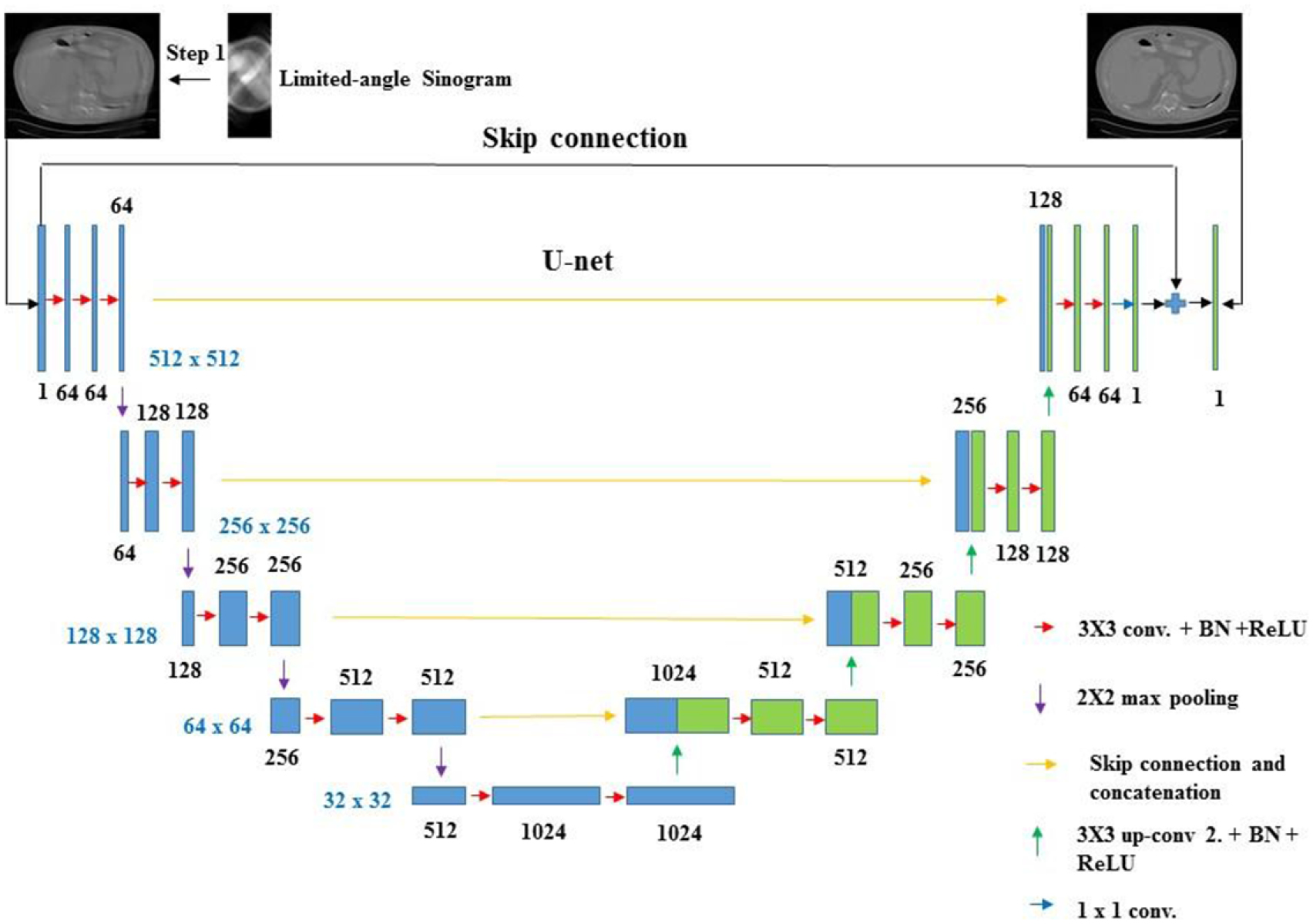 Mmd Algorithm Ct ADMM-based deep reconstruction for limited-angle CT - IOPscience