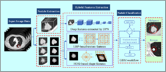 Classification of benign and malignant lung nodules from CT images ...
