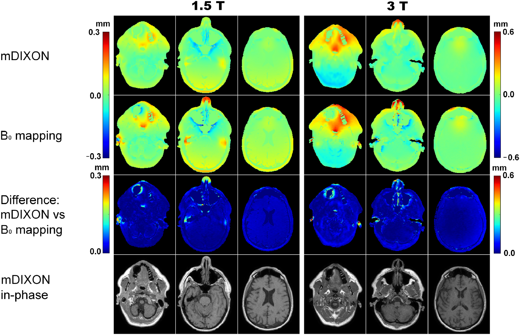 A novel and rapid approach to estimate patient-specific distortions ...