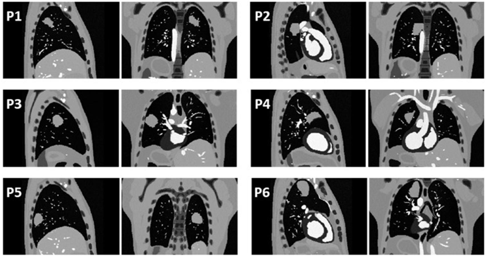 Mri Time Resolution Time-resolved volumetric MRI in MRI-guided radiotherapy: an in silico ...