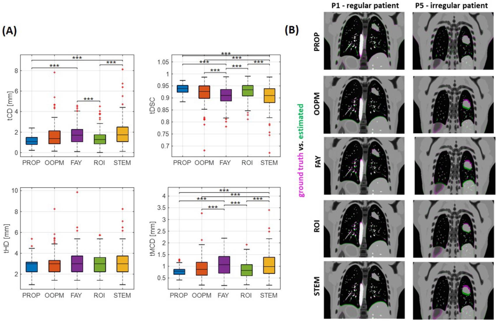 Mri Time Resolution Time-resolved volumetric MRI in MRI-guided radiotherapy: an in silico ...
