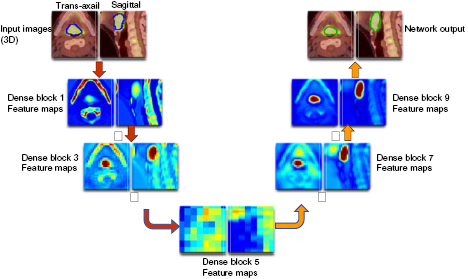 Gross tumor volume segmentation for head and neck cancer radiotherapy ...