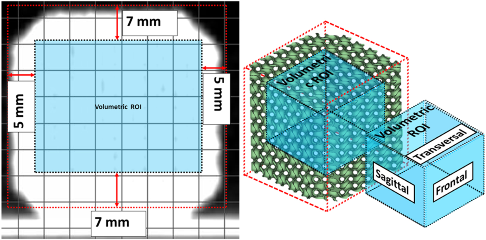 Gyroid Med Gyroid structures for 3D-printed heterogeneous radiotherapy phantoms ...