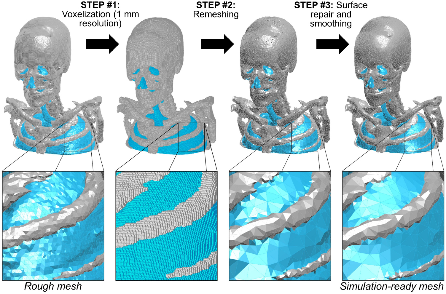 The ‘virtual DBS population’: five realistic computational models of ...