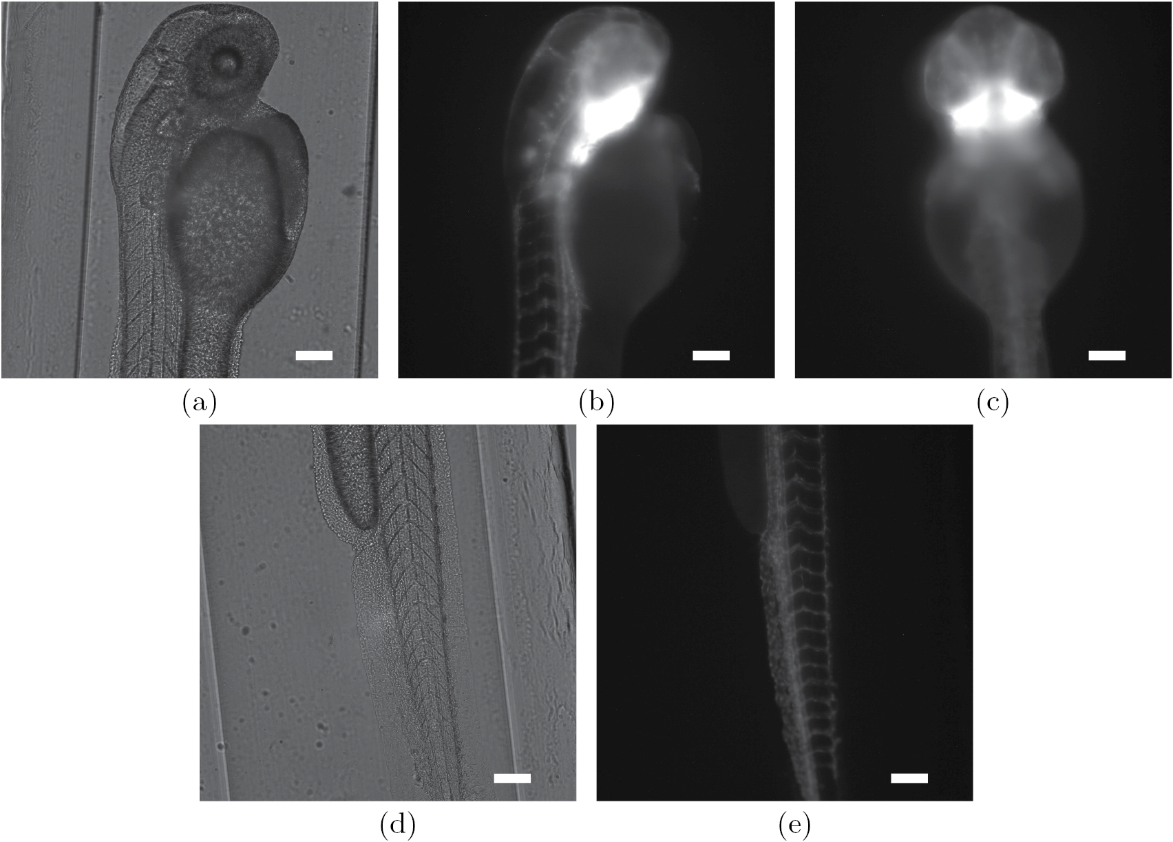 A mathematical model and iterative inversion for fluorescent optical ...