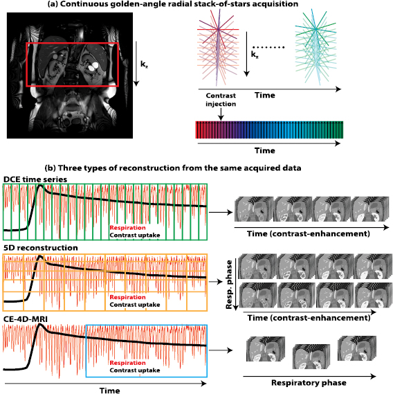 A dual-purpose MRI acquisition to combine 4D-MRI and dynamic contrast ...