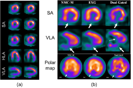 Recent advances in cardiac SPECT instrumentation and imaging methods ...