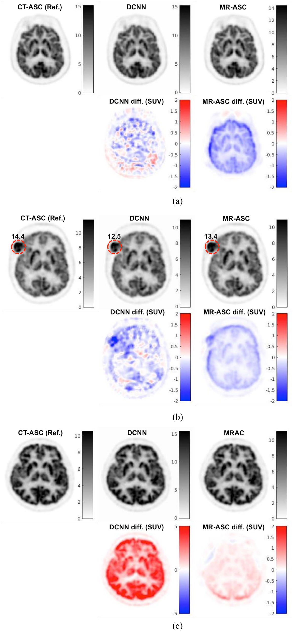Joint correction of attenuation and scatter in image space using deep ...