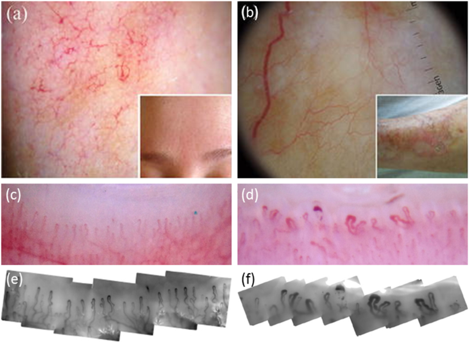 Microvascular imaging of the skin - IOPscience
