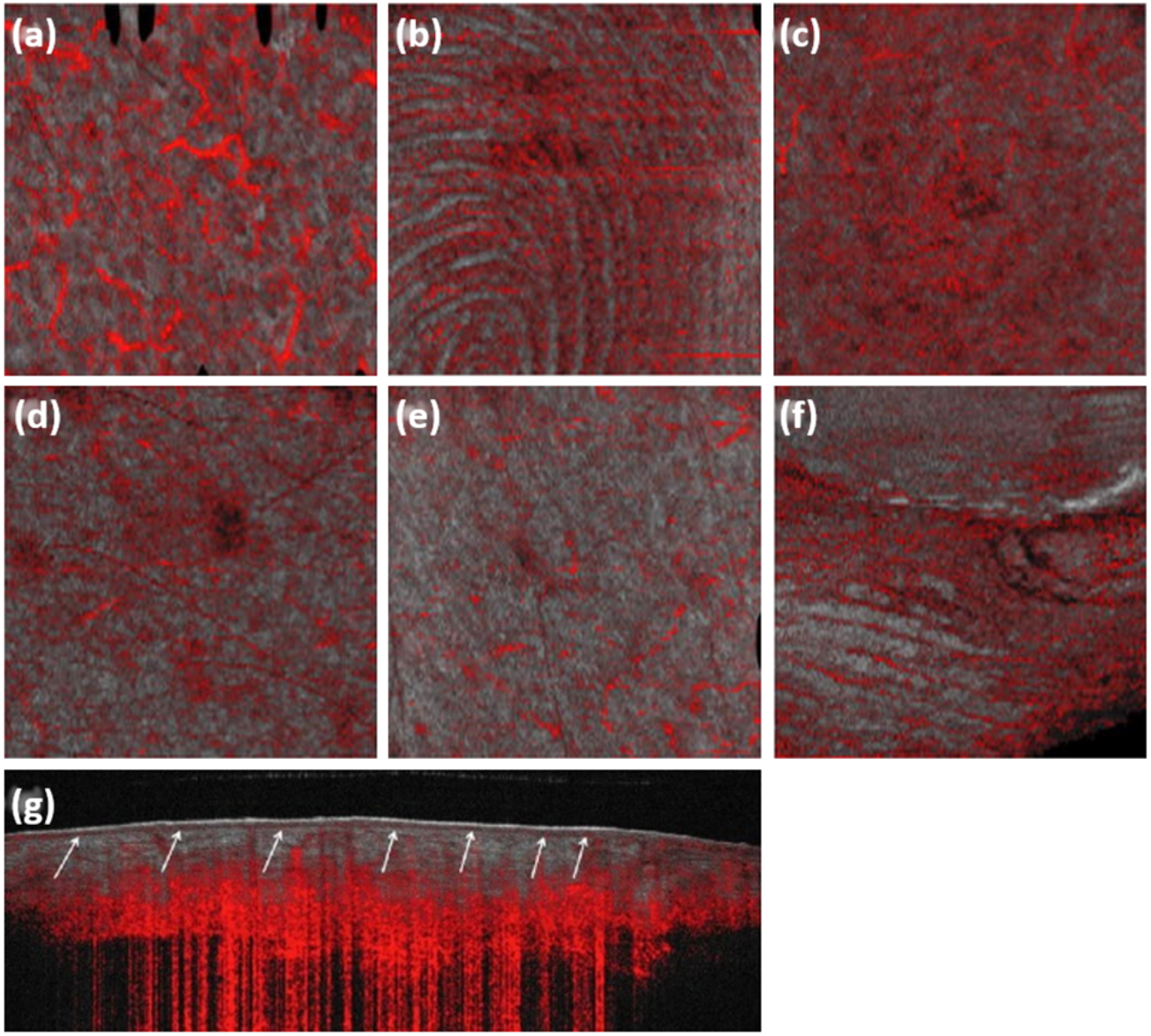 Microvascular imaging of the skin - IOPscience