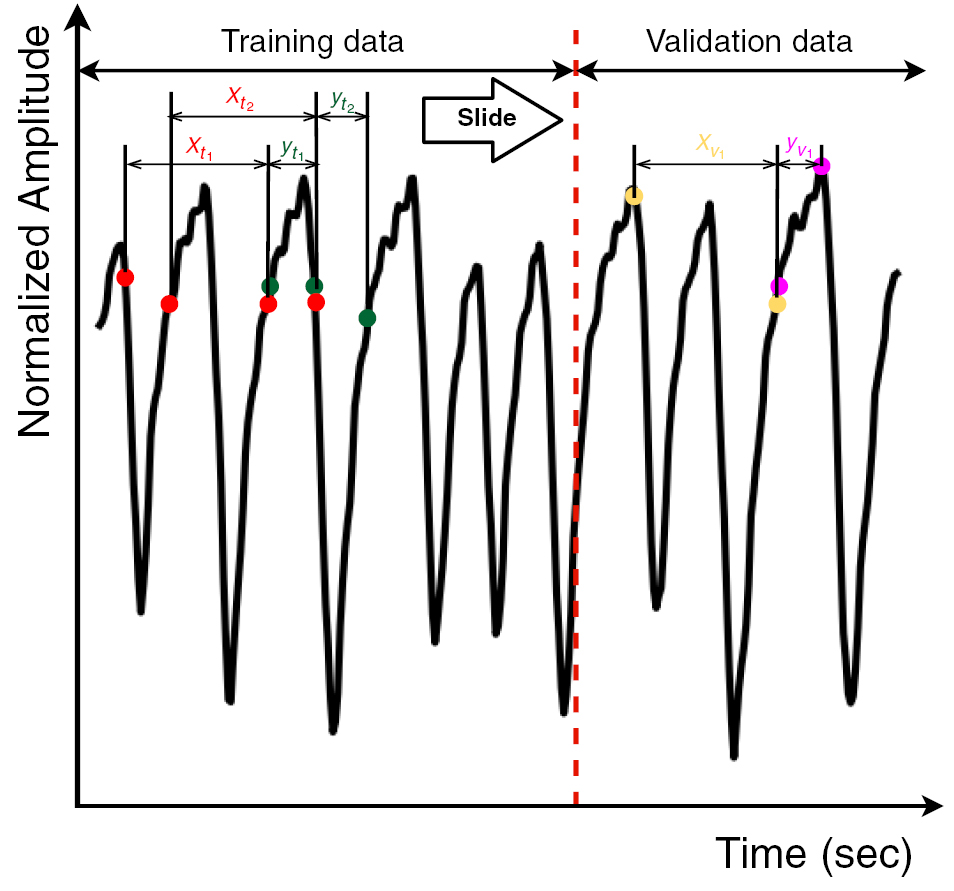 Towards real-time respiratory motion prediction based on long short ...