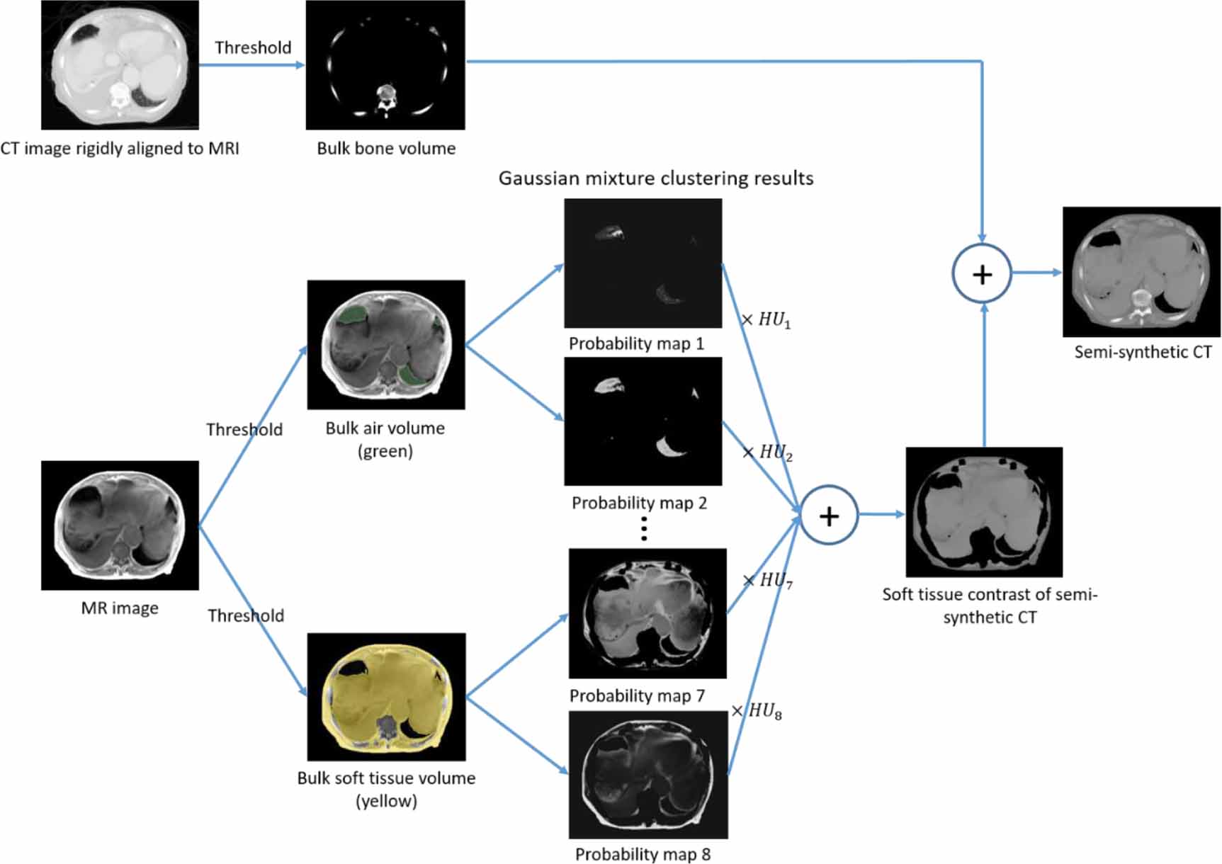 Abdominal synthetic CT generation from MR Dixon images using a U-net ...