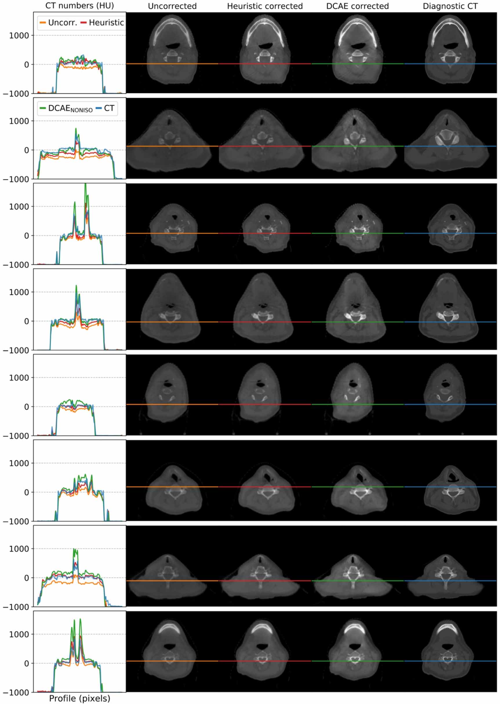 A Monte Carlo based scatter removal method for non-isocentric cone-beam ...