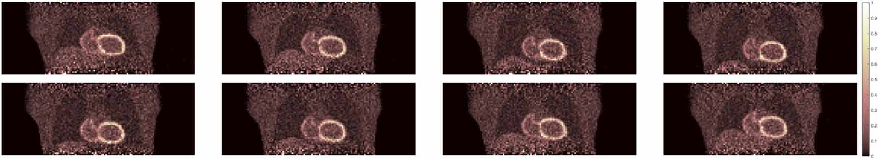 Motion correction of respiratory-gated PET images using deep learning ...