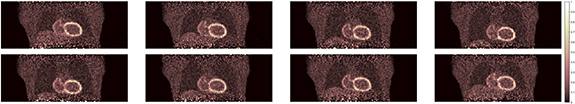 Motion correction of respiratory-gated PET images using deep learning ...