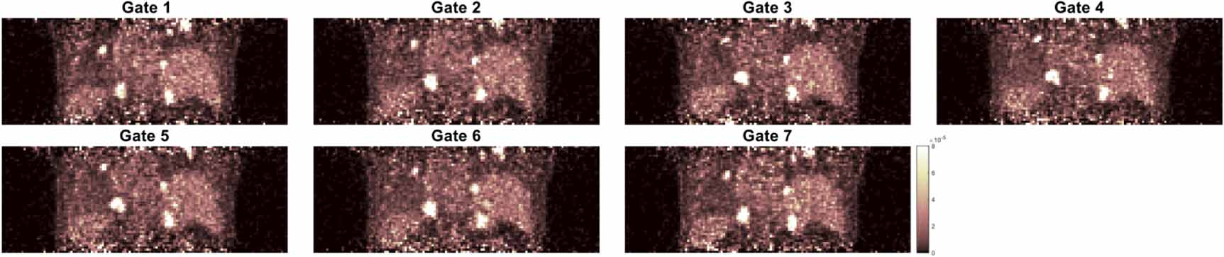 Motion correction of respiratory-gated PET images using deep learning ...