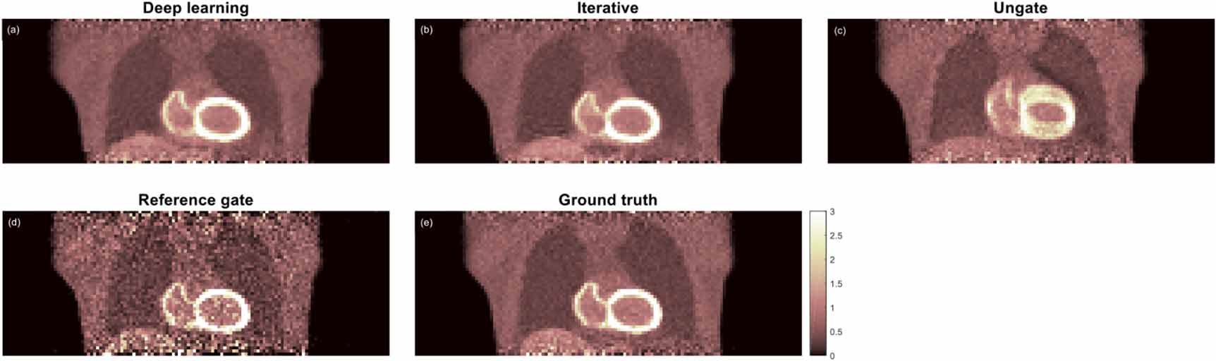 Motion correction of respiratory-gated PET images using deep learning ...