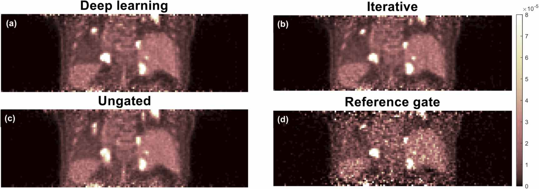 Motion correction of respiratory-gated PET images using deep learning ...