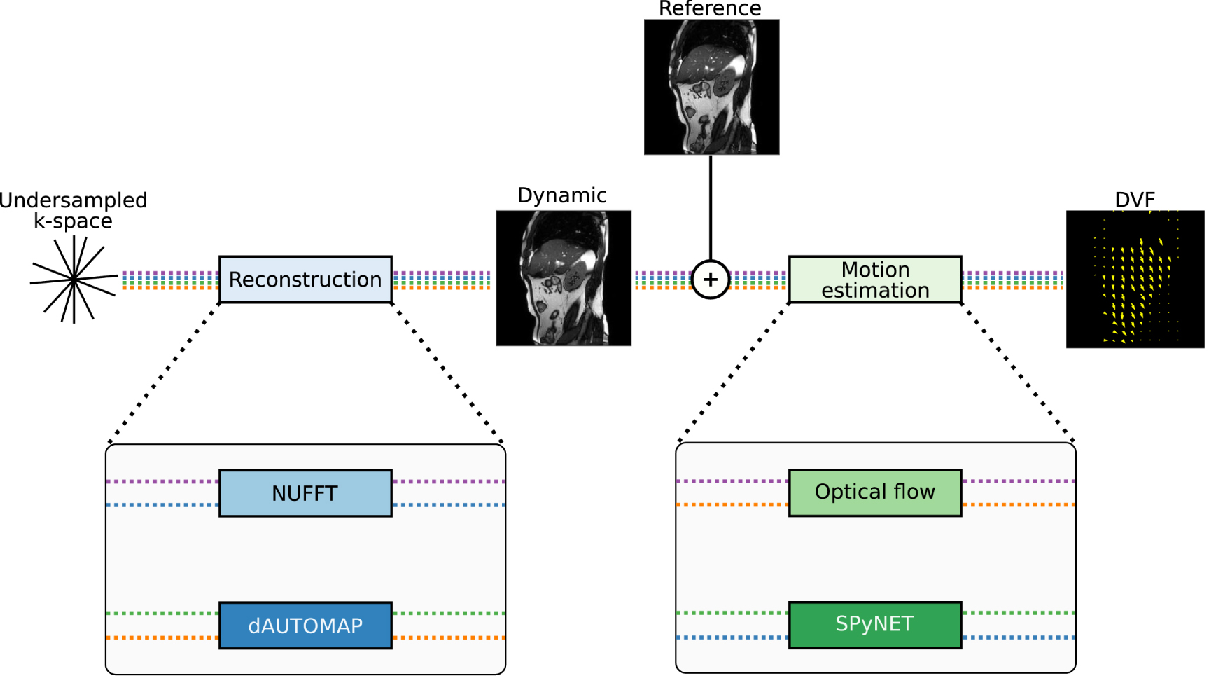 Deep learning-based image reconstruction and motion estimation from ...