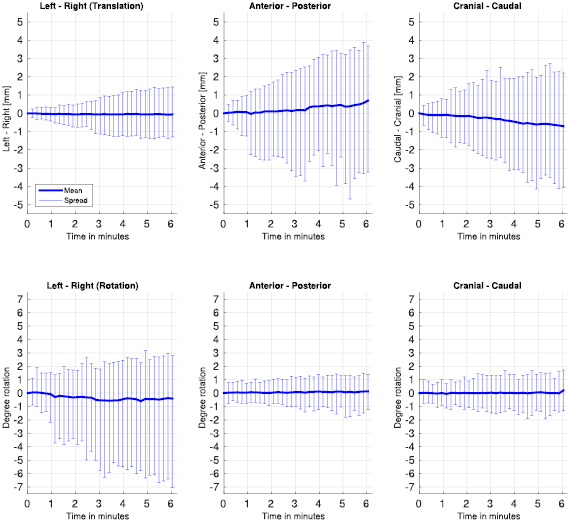 Dosimetric impact of soft-tissue based intrafraction motion from 3D ...