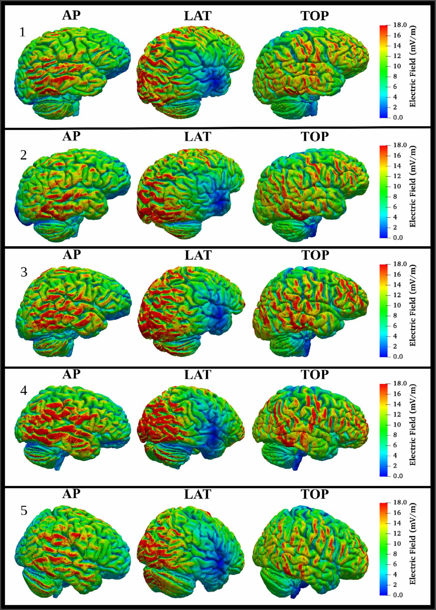 Inter-individual variations in electric fields induced in the brain by ...