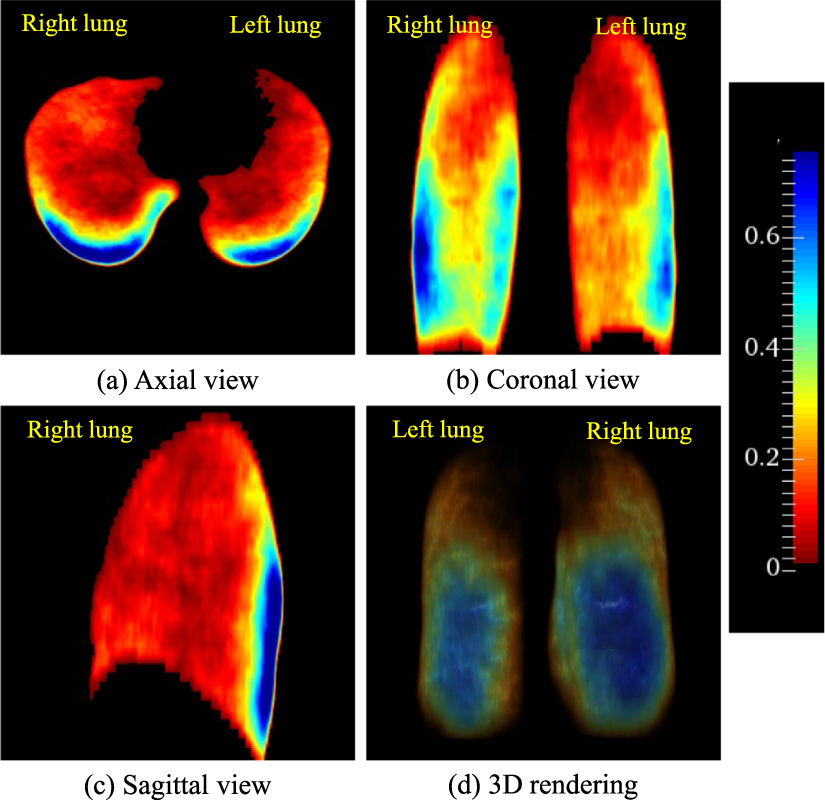 Active contour regularized semi-supervised learning for COVID-19 CT ...